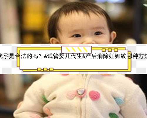 在中国代孕是合法的吗？&试管婴儿代生&产后消除妊娠纹哪种方法效果好